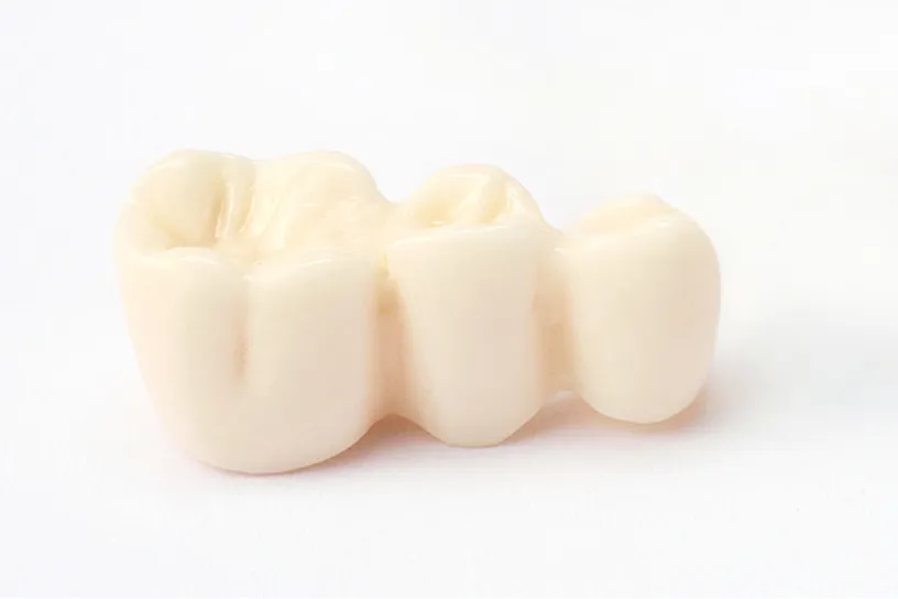 自家歯牙移植について